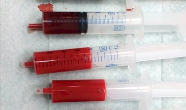 उपलब्धि : एनीमिया से जंग के मोर्चे पर हिमाचल प्रदेश देश में आठवें स्थान पर