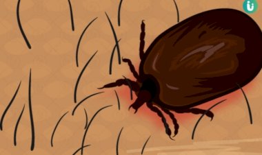 स्क्रब टाइफस रोग से रहें सतर्क, तेज बुखार होने पर अवश्य करवाएं जांच - मुख्य चिकित्सा अधिकारी