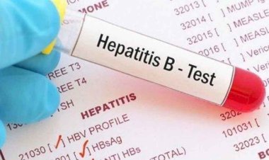 हेपेटाइटिस के मरीजों के लिए निःशुल्क दवा एवं जांच की सुविधा: अवस्थी