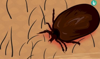 जिला शिमला में स्क्रब टायफस  बीमारी से अब तक 107 मरीज पाए गए संक्रमित ......