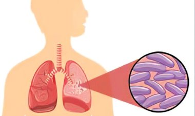 टीबी मुक्त पंचायतों के चयन के लिए शुरू होगा व्यापक सर्वे.... 15 जनवरी तक करना होगा दावा, 24 मार्च को होगी टीबी मुक्त की घोषणा.....