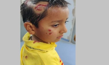 कुत्ते ने साढ़े 4 वर्षीय बच्चे को काटा, पहले भी कई को कर चूका है घायल