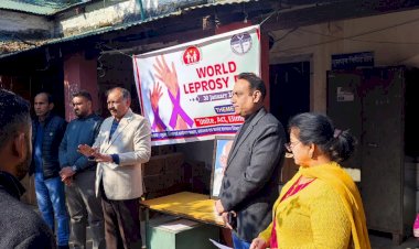 कुष्ठ रोग दीर्घकालिक संक्रमण हैं-अजय पाठक