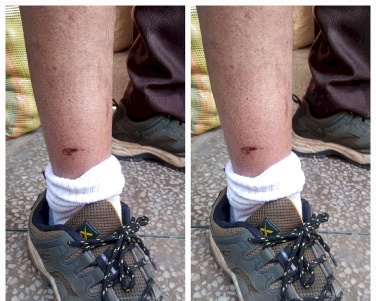 नाहन: नया बाजार में व्यापारी को, कच्चा टैंक में स्कूली छात्रा को काटा लावारिस हमलावर कुत्तों ने..