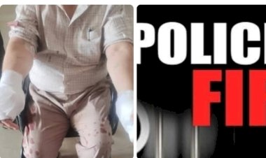 नाहन: दो सगे भाईयों के जमीनी विवाद में खूनी झड़प, छोटे भाई ने दराट से किया हमला, गर्दन पर किया वार, हाथ का अंगूठा कटा एफआईआर दर्ज...
