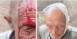नाहन : रेणूका क्षेत्र में 80 वर्षीय बुजुर्ग के साथ मारपीट,क़िया लहूलुहान..